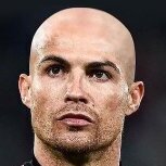 CR7 Careca