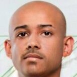 Bak careca